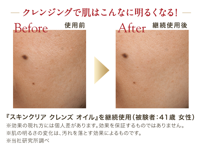 スキンクリア クレンズ オイル アロマタイプ リフレシングシトラスの