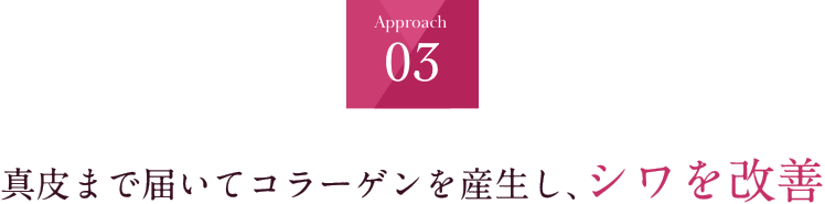 Approach03 真皮まで届いてコラーゲンを産生し、シワを改善