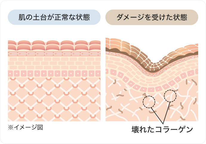 肌の土台が正常な状態 ダメージを受けた状態