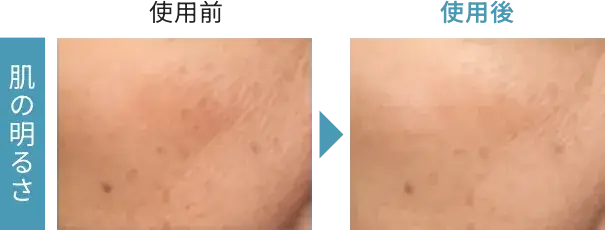 肌の明るさ 使用前と使用後