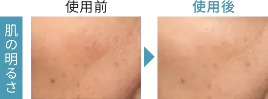 肌の明るさ 使用前と使用後