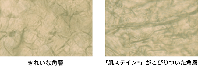 きれいな角層に「肌ステイン」こびりついた