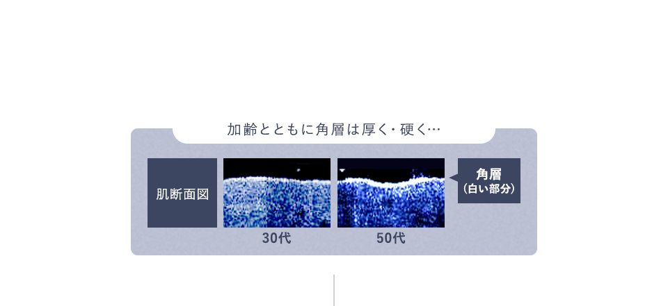角層が厚く硬くなると、スキンケアが必要な所に届かず、ハリが低下＆エイジング悩みを加速。