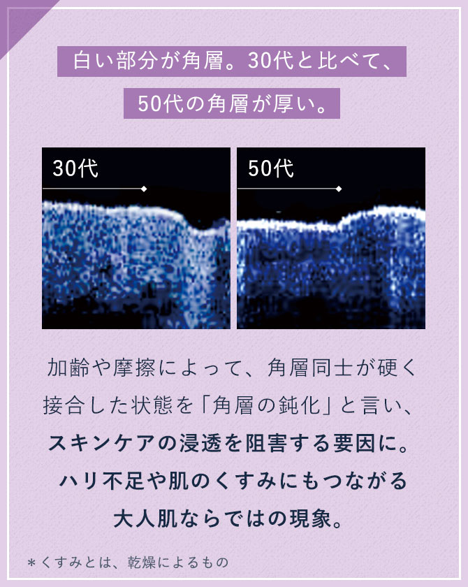 【白い部分が角層。30代と比べて、50代の角層が厚い。】加齢や摩擦によって、角層同士が硬く接合した状態を「角層の鈍化」と言い、スキンケアの浸透を阻害する要因に。ハリ不足や肌のくすみにもつながる大人肌ならではの現象。＊くすみとは、乾燥によるもの