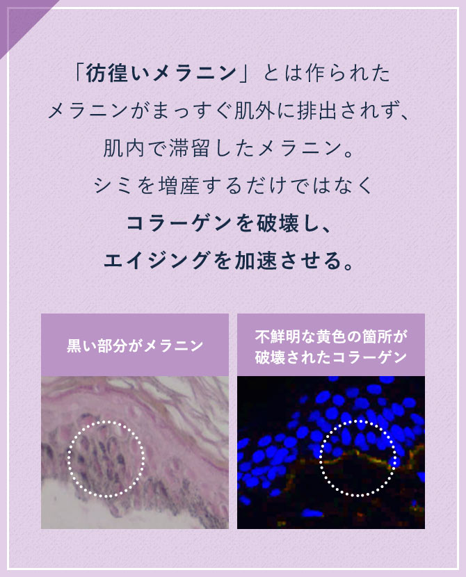 「彷徨いメラニン」とは作られたメラニンがまっすぐ肌外に排出されず、肌内で滞留したメラニン。シミを増産するだけではなくコラーゲンを破壊し、エイジングを加速させる。