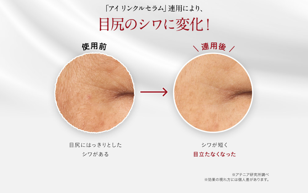 目尻クライシス」に攻めの一手。「シワ改善」美容液-アイ リンクル