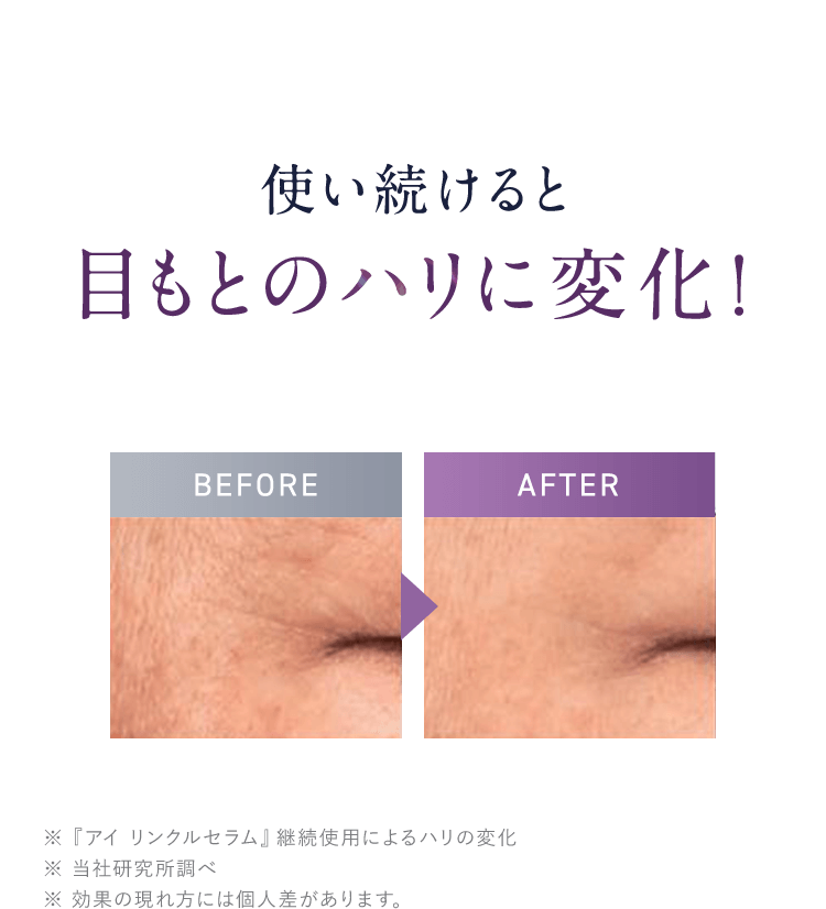 使い続けると目もとのハリに変化！