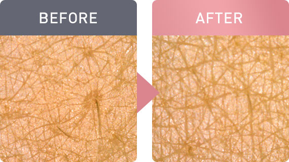 キメが細かく均一に