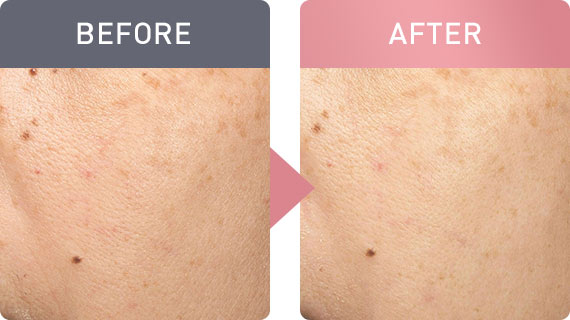 ふっくら明るい肌へ 