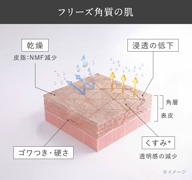【フリーズ角質とは？】加齢や摩擦によって角質の骨組みである「骨格タンパク」が増えすぎて角層が硬くなった状態。肌がゴワつき、くすみ＊やすくなりスキンケアの浸透力低下の原因にも。どんより肌の原因は他にも…