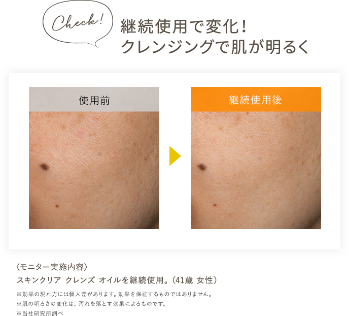 check!継続仕様で変化！クレンジングで肌が明るく