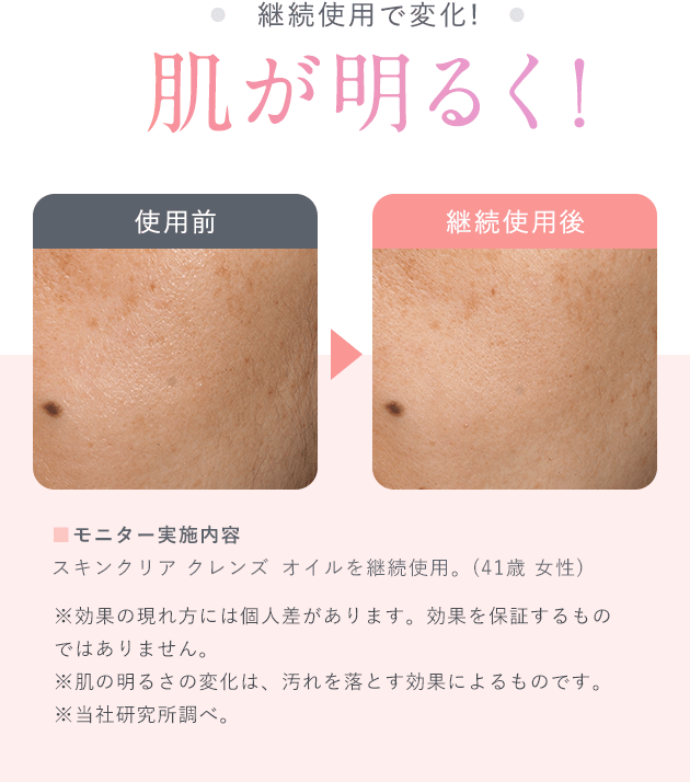 【継続使用で変化!！肌が明るく！】■モニター実施内容スキンクリア クレンズ オイルを継続使用。(41歳 女性)※効果の現れ方には個人差があります。効果を保証するものではありません。※肌の明るさの変化は、汚れを落とす効果によるものです。※当社研究所調べ。