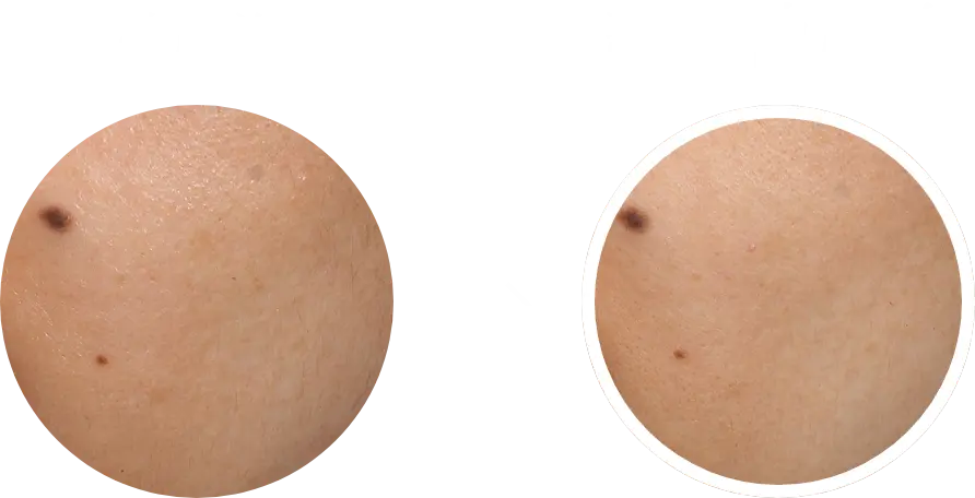 使用前と継続使用後の比較画像