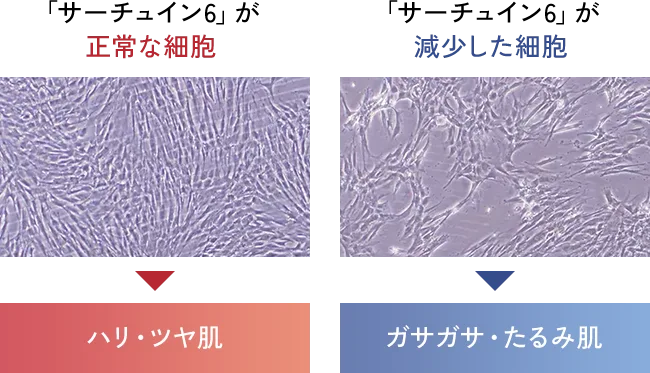 「サーチュイン6」が正常な/減少した細胞